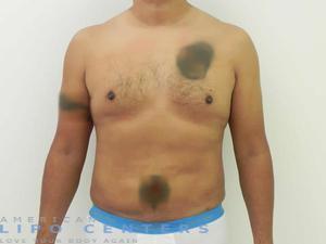 americanlipocenters_201.jpg